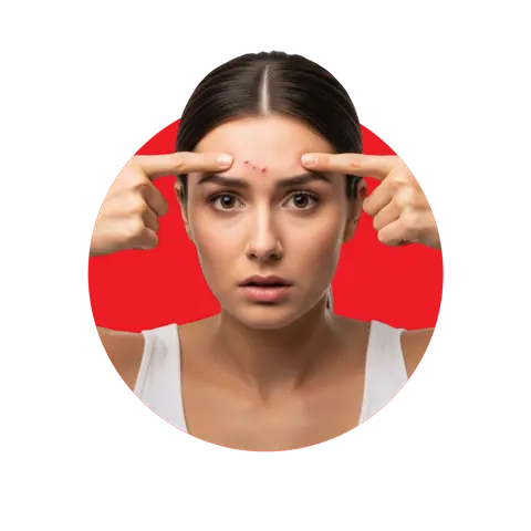 Young woman checking acne pimples on her forehead highlighting skin concerns and breakouts