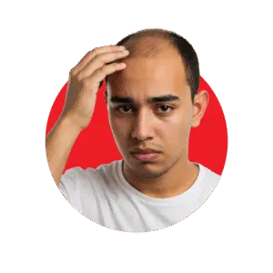 Young man touching his thinning hairline showing early signs of male pattern baldness and hair loss